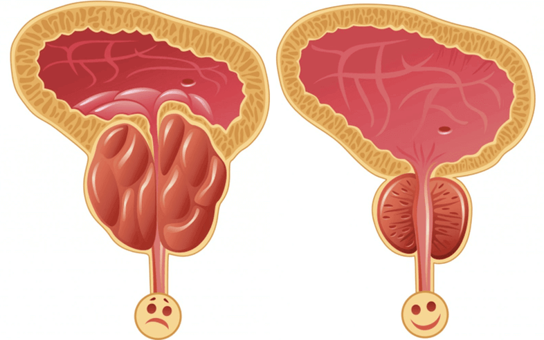 Potentsiprobleemide põhjused meestel